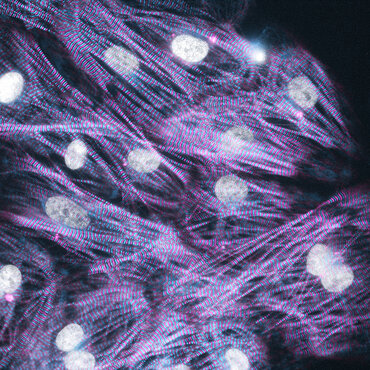 Bild zur Presseinformation "Präzisionsmedizin für seltene Herzerkrankung: Göttinger Forschung erhält Millionenförderung"