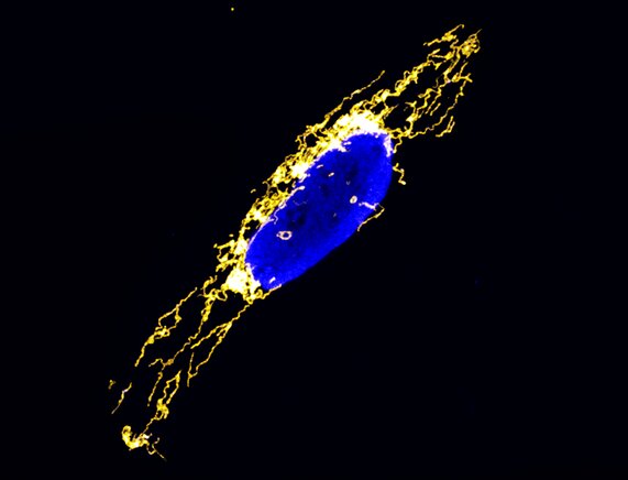 Bild zur Presseinformation "Tempokontrolle bei der mitochondrialen Proteinproduktion entdeckt"