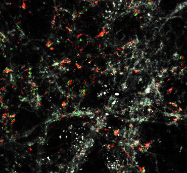 Bild zur Presseinformation "Sonderforschungsbereich an der UMG geht in die dritte Förderperiode"