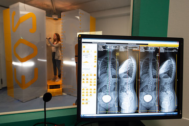 Junge Patientin im neuen strahlungsarmen 3D-Röntgengerät mit den Röntgenbildern.