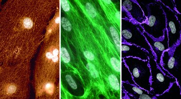 Bild zur Presseinformation "Neue Perspektive bei Noonan-Syndrom: zentraler Mechanismus für Herzveränderungen identifiziert"