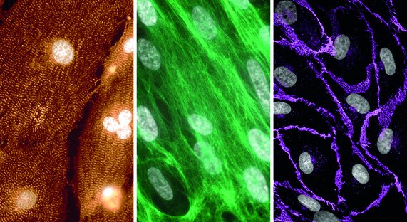 Bild zur Presseinformation "Neue Perspektive bei Noonan-Syndrom: zentraler Mechanismus für Herzveränderungen identifiziert"