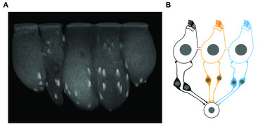 Abbildung: gekoppelte Haarsinneszellen (links) Fluoreszenzmikroskopische Aufnahme eines Zellverbands von fünf gekoppelten inneren Haarsinneszellen (birnenförmig mit hellen Punkten). Die zweite Zelle von links wurde mittels der Patch-Clamp-Technik mit einer fluoreszierenden Sonde beladen, die sich von dort in die benachbarten Haarsinneszellen ausgebreitet hat und die synaptischen Bänder markiert (helle Punkte). Größenstandard: 5 µm. Quelle: Institut für Auditorische Neurowissenschaften / UMG. (rechts) Zellverband von drei gekoppelten inneren Haarsinneszellen (die Verbindung ist vereinfacht als durch die verschmolzenen Zellhüllen gebildete Röhre dargestellt). Die elektrischen Signale der Zellen werden durch die Kopplung übermittelt. Dies vermindert das stochastische Rauschen bei der Weitergabe der Information an den Bandsynapsen der Hörnervenzellen, die wiederum die Information auf eine gemeinsame Zielzelle übertragen, was das Rauschen weiter reduziert und in einer höheren Hörempfindlichkeit resultiert. Quelle: Jean et al., Nat Commun, 2020; Suppl. Part)