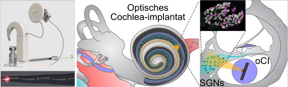 Link zur Presseinformation Nr. 109 / 2022 zum Thema "Land Niedersachsen fördert die vorklinische Entwicklung des optischen Cochlea Implantats"