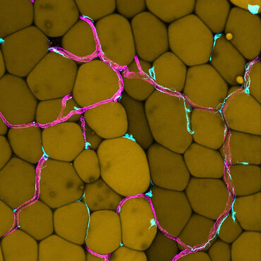 Picture for press release "How excessive fat tissue affects our blood vessels – new insights into vascular health in obesity"