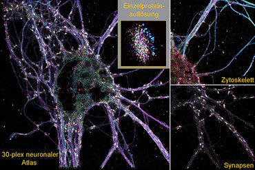 Pressemitteilung zum Thema "Neue bildgebende Methode ermöglicht Identifizierung seltener Synapsen im Gehirn"